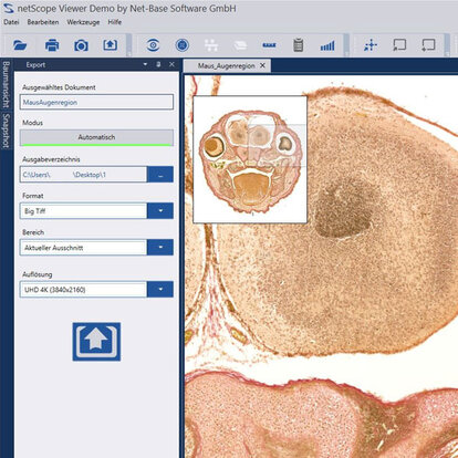THE BEST VIEWER FOR CZI WHOLE SLIDE IMAGING