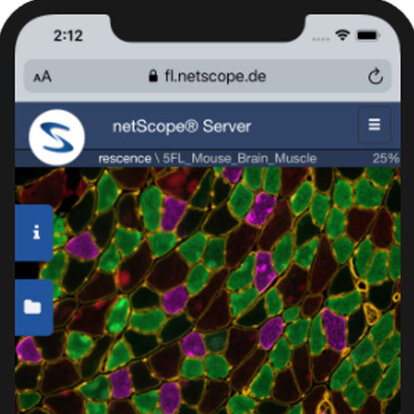  Bei netScope Cloud gibt es kein Tracking und keine Werbung